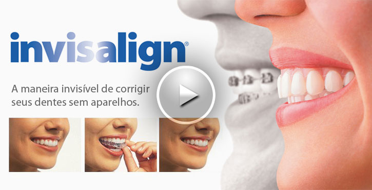 Apresentamos Invisalign®.