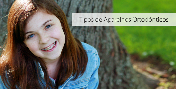 Ortodontia com aparelho dentário especial e tempo de tratamento pré-estipulado